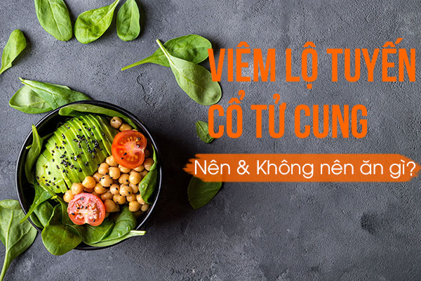 Những loại thực phẩm nào nên tránh khi mắc viêm lộ tuyến?
