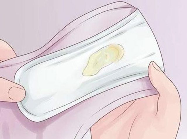 Khí hư màu vàng cảnh báo bệnh viêm âm đạo