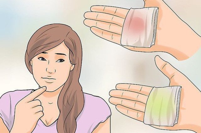 Khí hư có mùi, màu sắc bất thường là biểu hiện đặc trưng của bệnh phụ khoa ở tuổi dậy thì