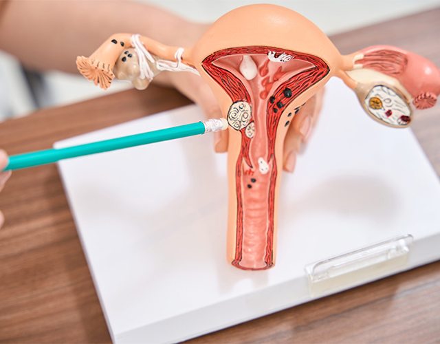 Viêm phụ khoa: Nguyên nhân, dấu hiệu và cách xử lý!